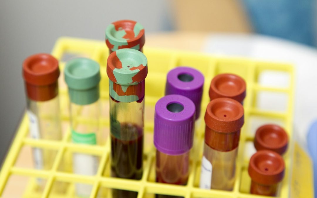 Six-Monthly Medical Examination (6ME) in Singapore: Complete Employer Screening Guide